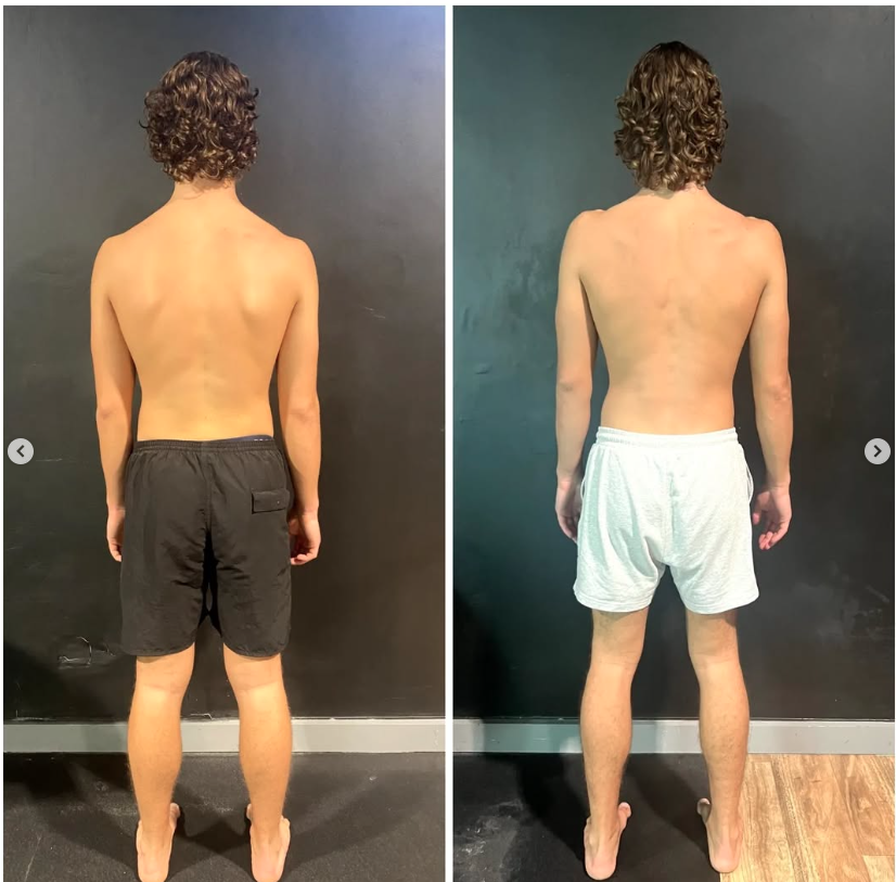 Hugo back posture and structure progress
