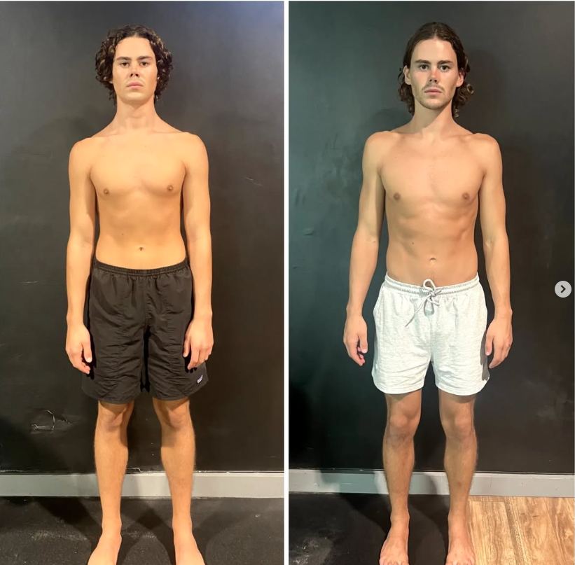 Hugo front posture and structure progress